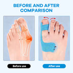 Färdigskuren kinesiologitejp för hallux valgus