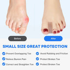 Tåseparator och hallux valgus-korrigerare