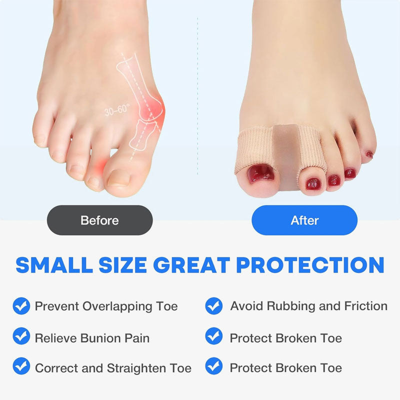 Tåseparator och hallux valgus-korrigerare